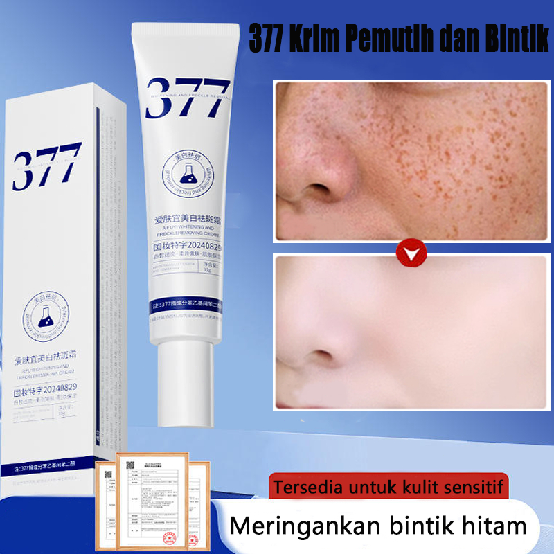 Krim Pemutih dan Bintik 377 Krim Bintik Krim Bintik Permanen Menghilangkan Flek Hitam Bintik-bintik/