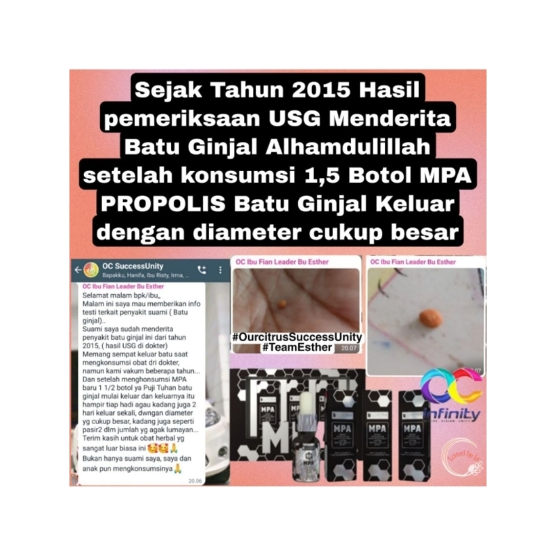 

MPA Propolis/Brazillian Propolis/Asine/Madu Trigona/Asam Amino/Nutrisi Kesehatan