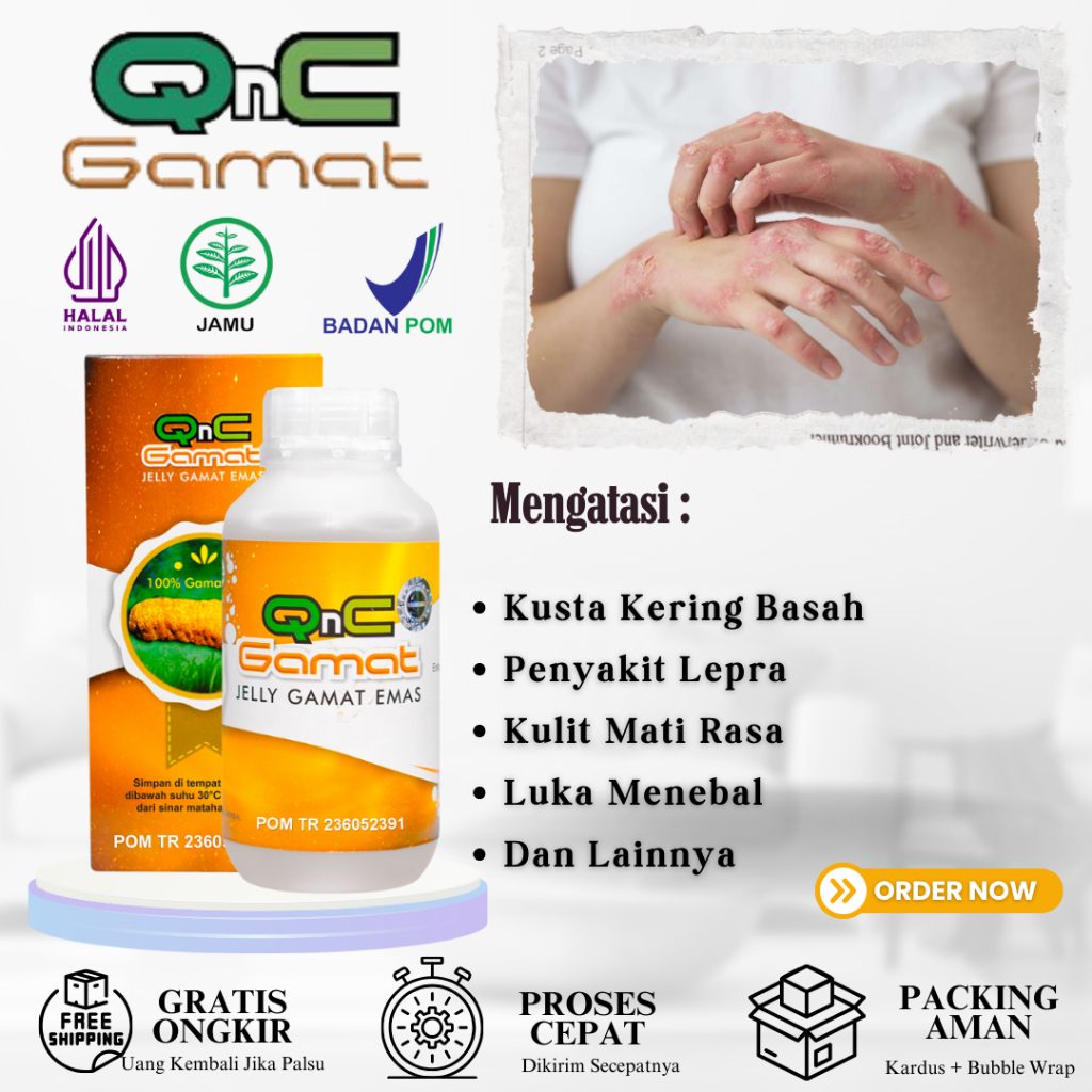 Obat Kusta/ Lepra, Kulit Mati Rasa, Kusta Kering dan Basah, Luka Menebal, Infeksi Jamur Kulit Dengan