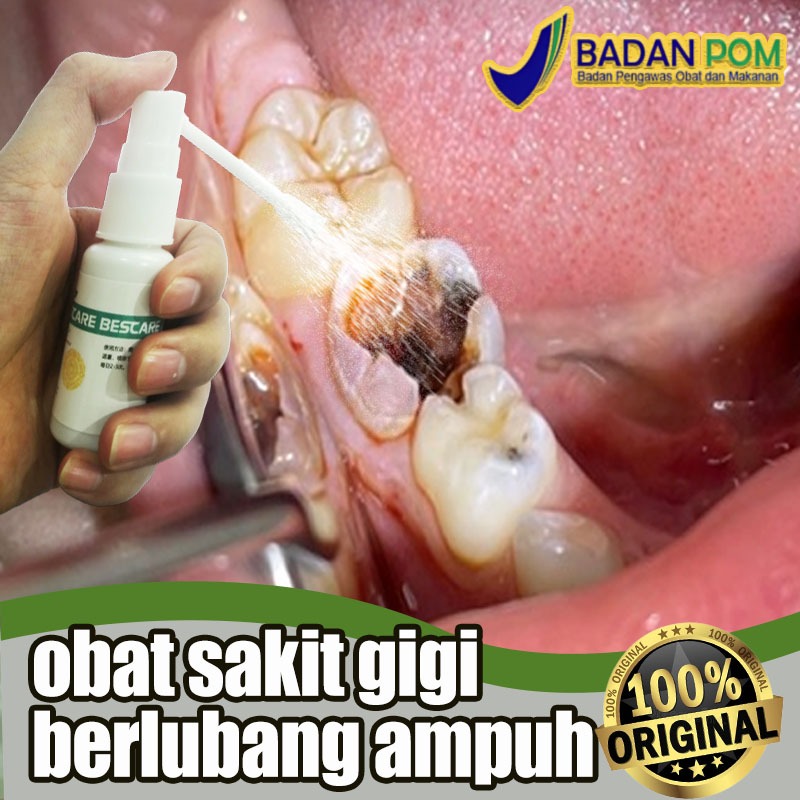 Obat sakit gigi berlubang ampuh Obat sakit gigi paling ampuh obat sakit gigi ampuh Obat gigi berluba