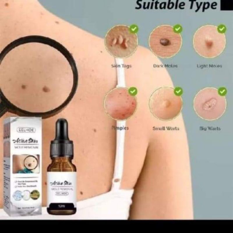 EELHOE SERUM  PENGHILANG KUTIL DAN TAHIL LALAT