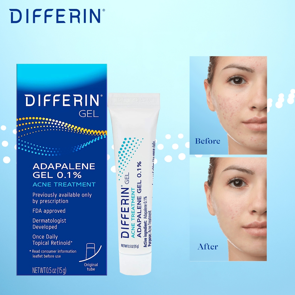 Differin Acne Treatment Gel / Differin Adapalene Gel 0.1% Acne Treatment 45g