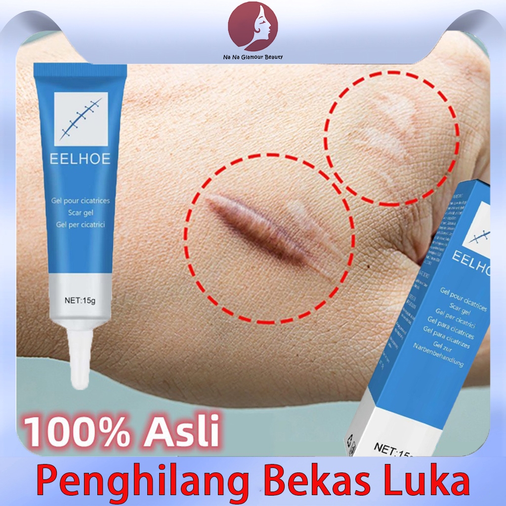 Salep penghilang bekas luka Penghilang bekas luka Obat penghilang bekas luka Krim perbaikan untuk be