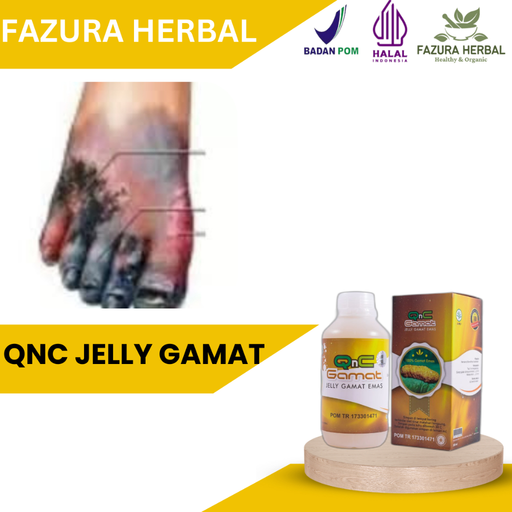 QnC Jelly Gamat - Obat Luka Diabetes, Obat Luka Diabetes Menghitam, Obat Luka Diabetes Basah