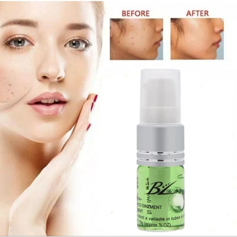 [ ORIGINAL ] BL Krim Cream Gel Penghilang Tahi Lalat Bintik Hitam Flek Freckle Kutil