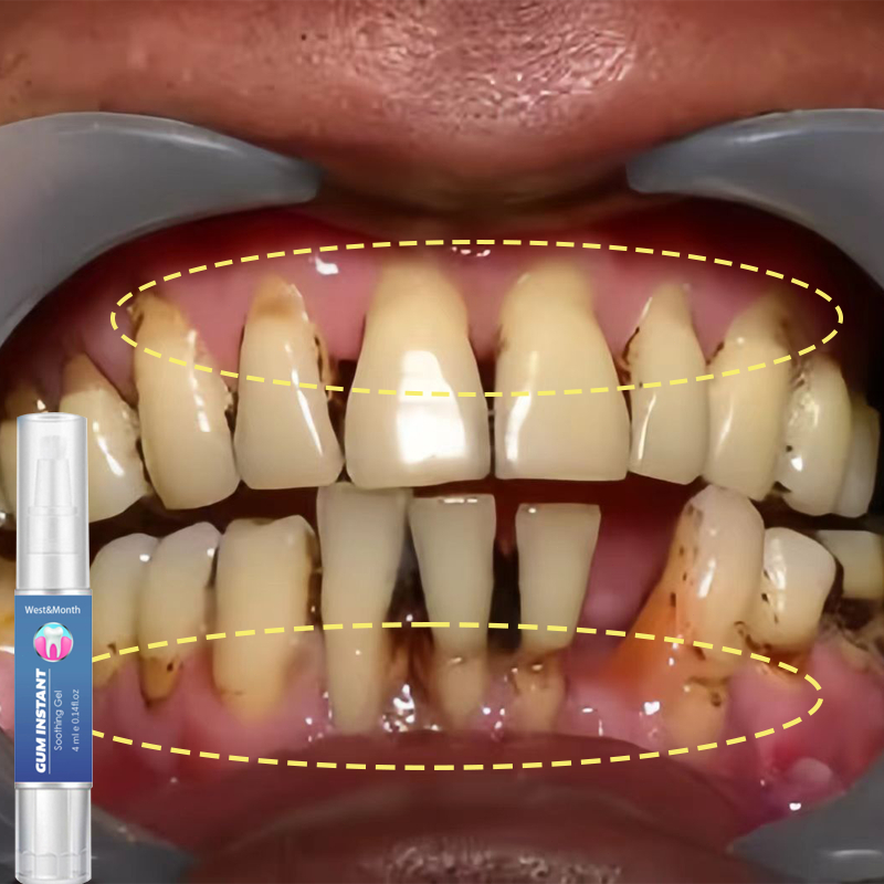 gumshield penghilang karang gigi obat gusi bengkak penguat gigi goyang gusi bengkak obat sakit gigi 