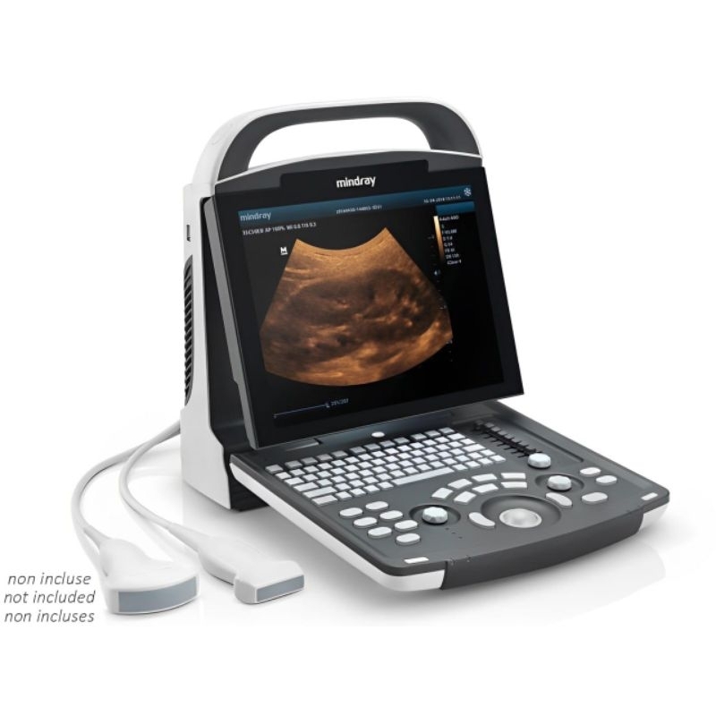 USG Mindray DP 20 / USG Mindray DP-20 2 Dimensi