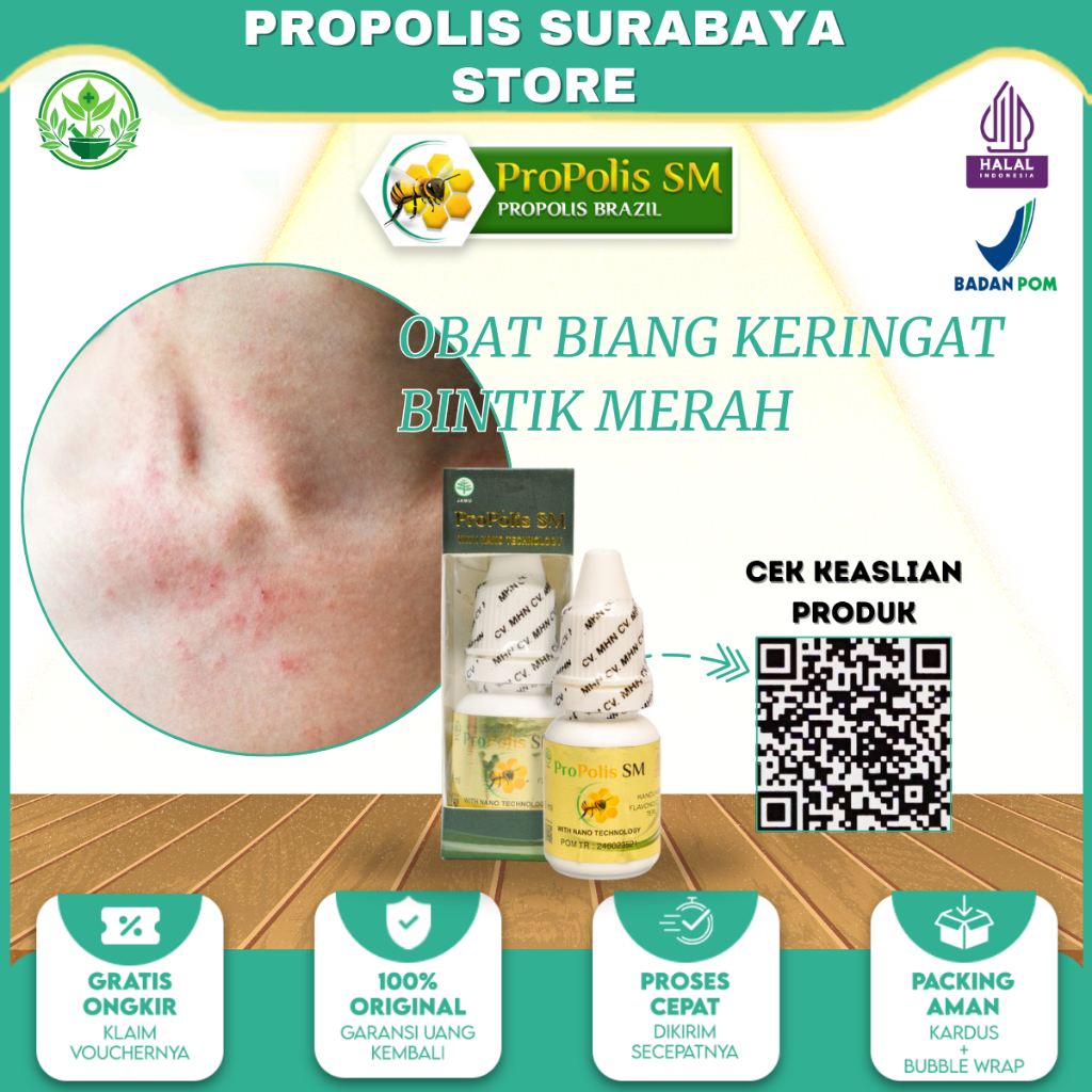 Obat Biang Keringat Bintik Bintik Merah Obat Kulit Gatal Kulit Ruam Merah Propolis SM 100% Original