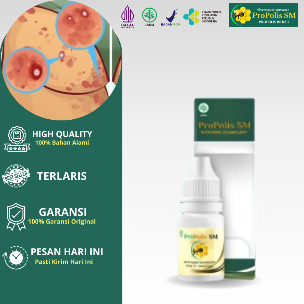 Obat Gatal Pantat, Obat Pantat Burik, Obat Pantat Gatal dan Hitam, Obat Beruntusan di Pantat, Obat G