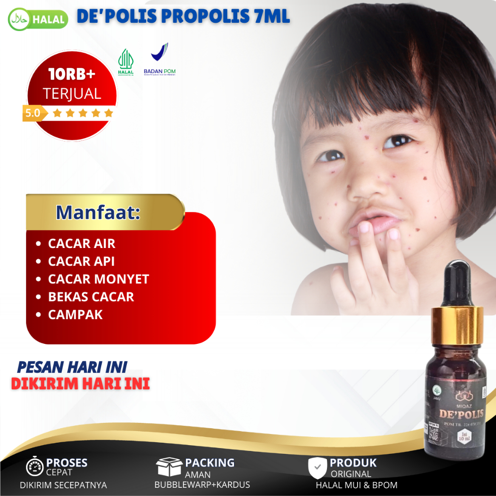 Obat Cacar Air Anak Dan Dewasa Cacar Api Penghilang Bekas Cacar Bintik Bintik Merah Cacar Monyet Ber