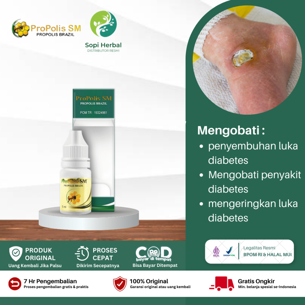 Obat Luka Diabetes Agar Cepat Kering, Obat Luka Diabetes Basah Bernanah, Luka Diabetes Basah Kering,