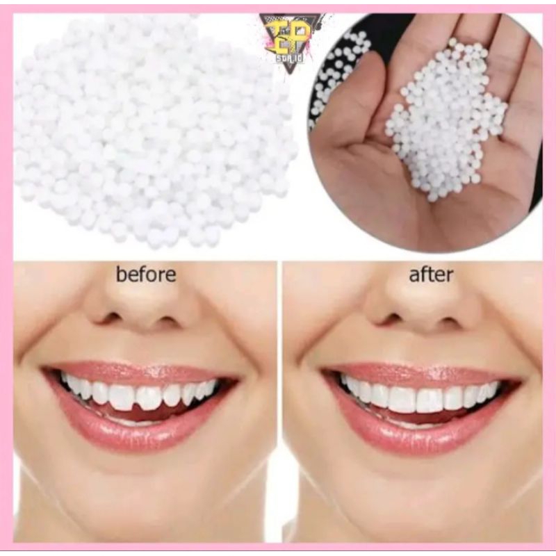 Penambal gigi sementara TEMPTOOTH