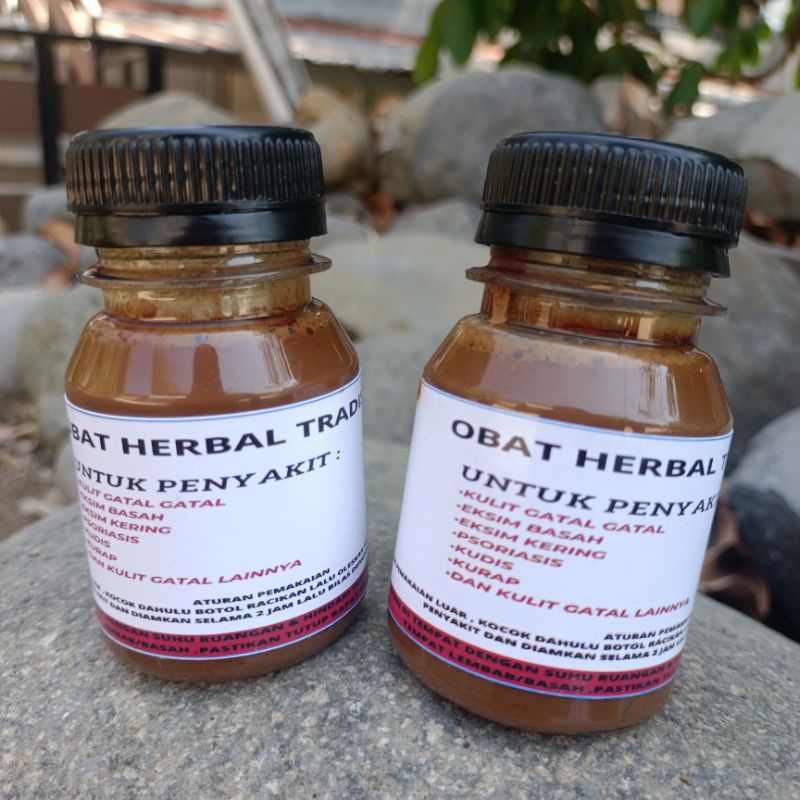 OBAT HERBAL TRADISIONAL RACIKAN KHUSUS PENYAKIT EKSIM ,PSORIASIS ,KUDIS ,KURAP ,KULIT GATAL GATAL