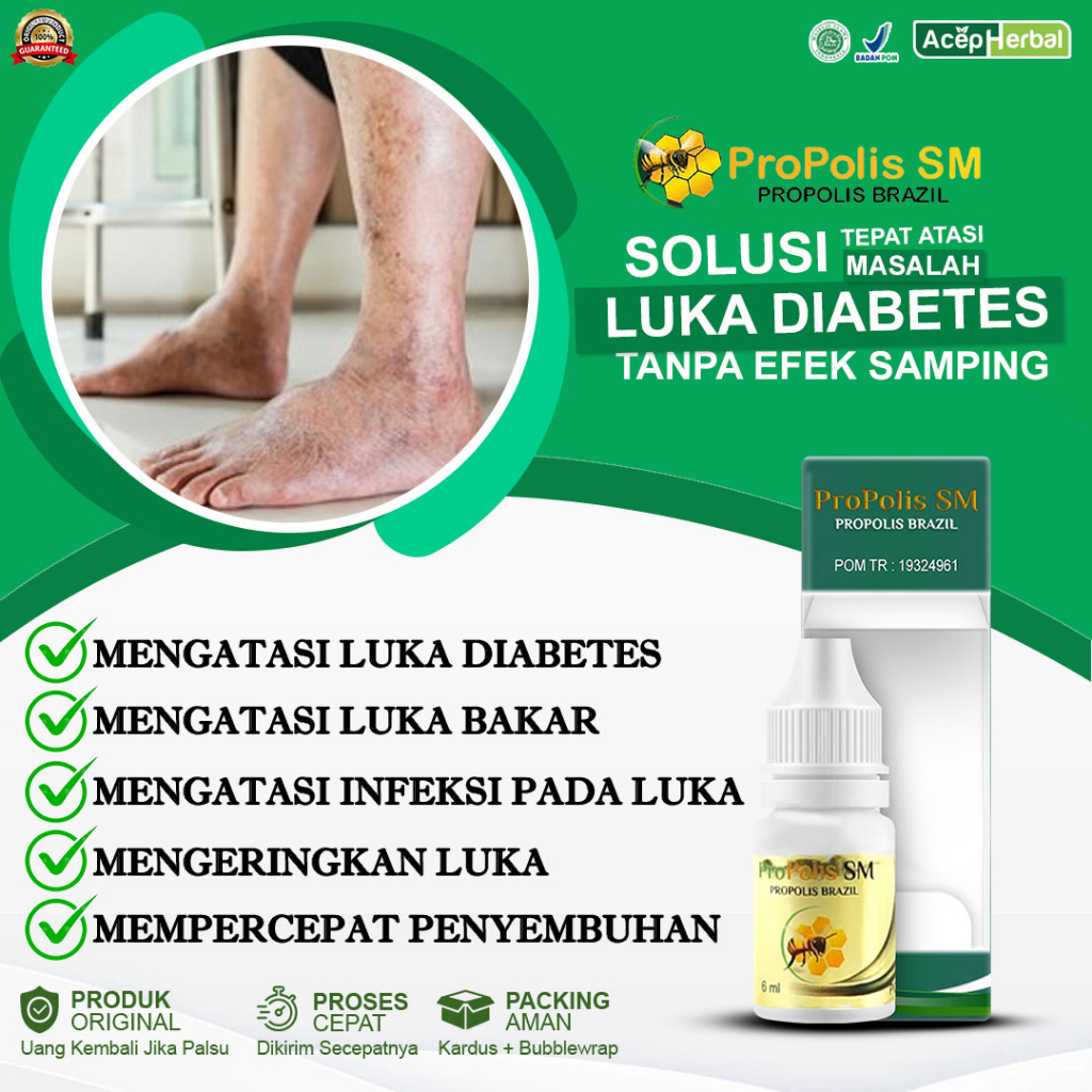 Obat Luka Diabetes Obat Pengering Luka Diabetes Obat Luka Diabetes Kering Obat Luka Diabetes Basah L