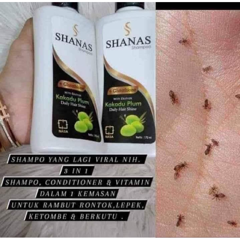 Shanas nasa Shampo kutu /shanas shampo ori/ shampo kutu/ shanas Nasa
