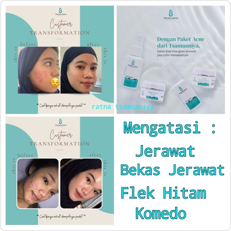 Tsamaaniya Skincare ACNE SOLUTION (BPOM)