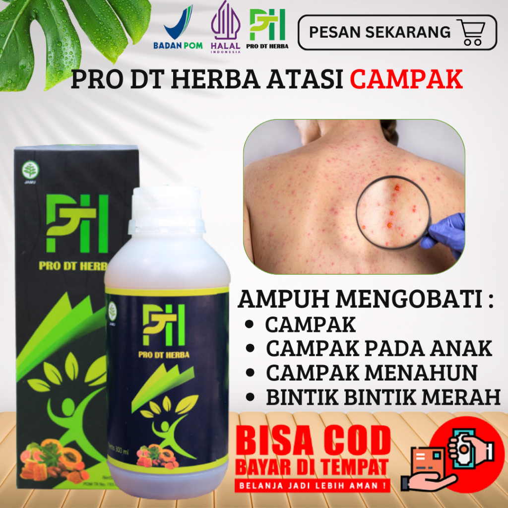 Obat campak paling ampuh, obat campak 100% original BPOM, campak anak, campak anak dewasa, campak ma