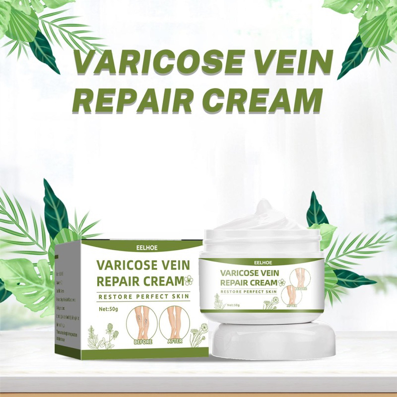 EELHOE Varicose Veins Cream Obat Varises Kaki Ampuh Obat Varises Kaki Krim Medis Pengobatan Varises,