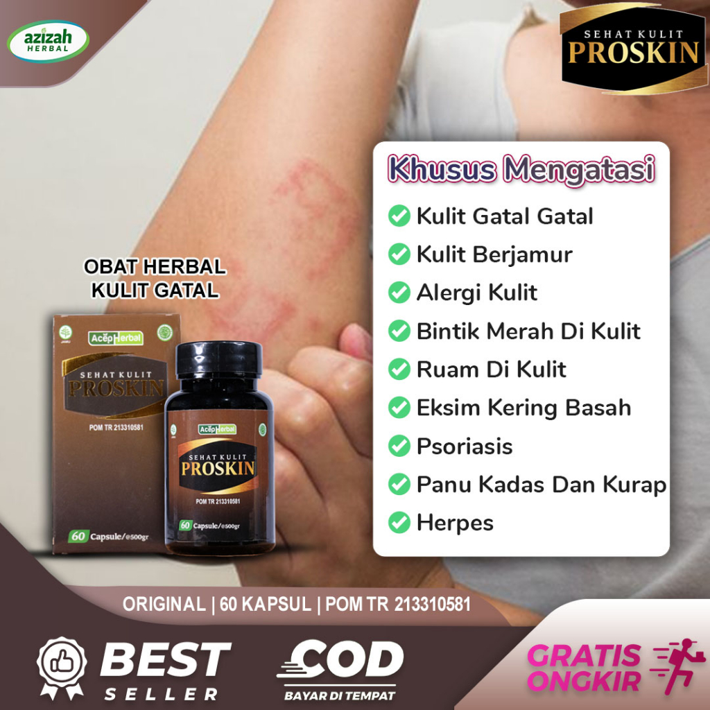 Obat Kulit Gatal Gatal Seluruh Badan Jamu Kulit Eksim Kadas Kurap Panu
Hapuran Alergi Biduran Bintik Merah Di Kulit Bentol Bruntusan Spesialis
Penyakit Kulit Herbal Proskin