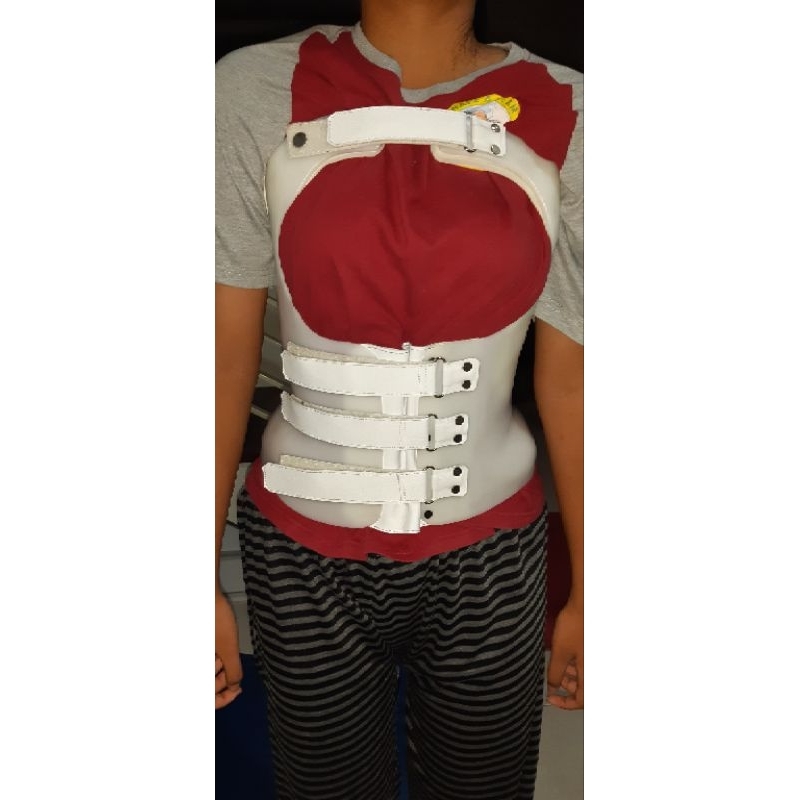 MSO SKOLIOSIS BRACE