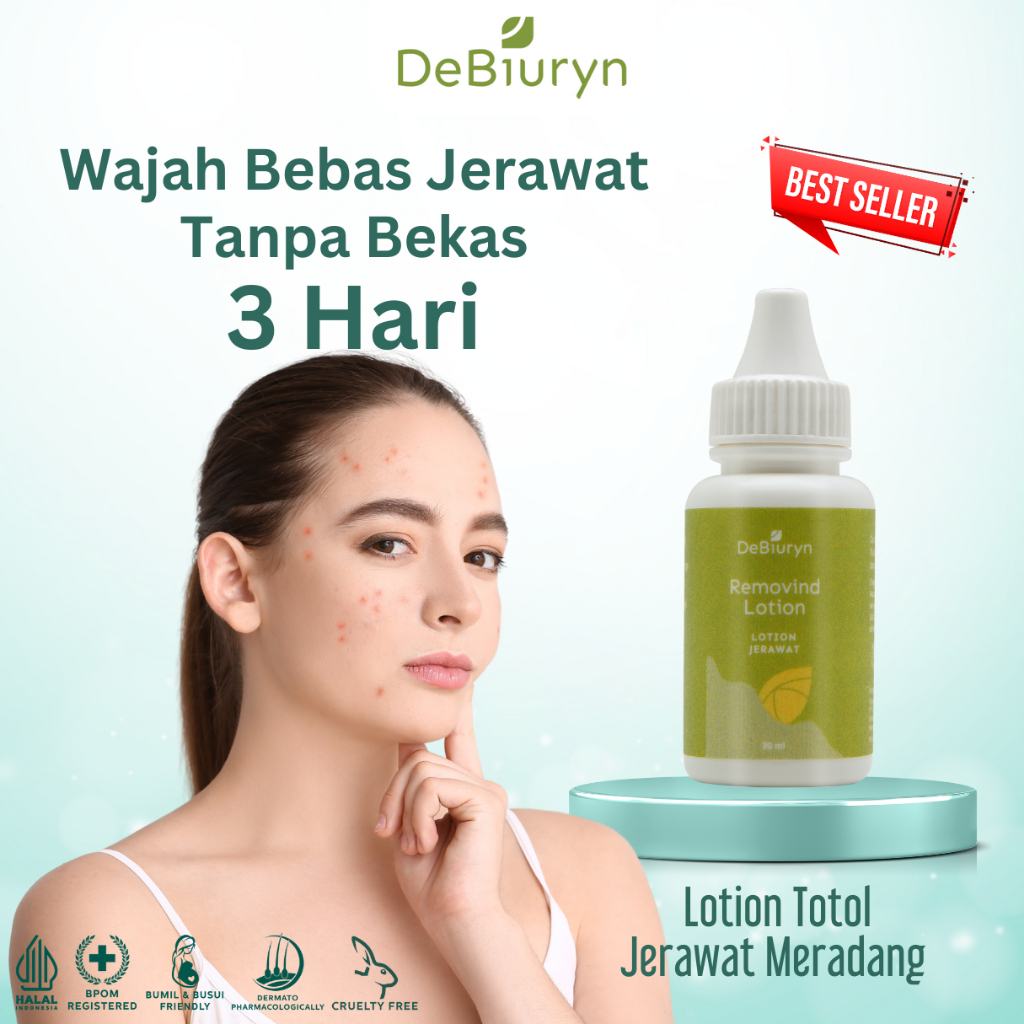 DeBiuryn Removind Acne Spot Treatment Lotion 30ml - Totol Jerawat
