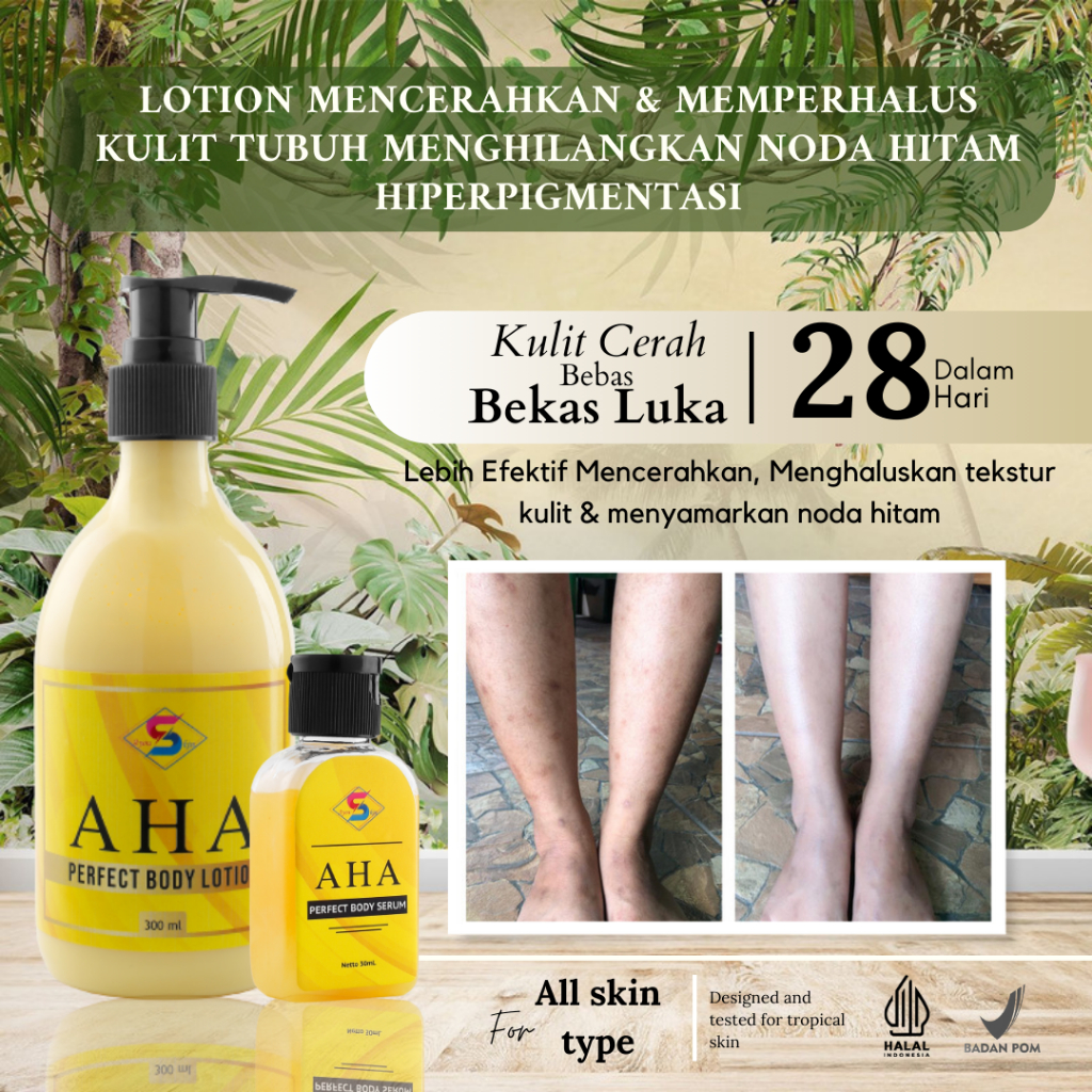 [BPOM] Ayouskin AHA Body Lotion Pencerah Pemutih Badan, Menghaluskan Kulit Tubuh, Penghilang Bekas L
