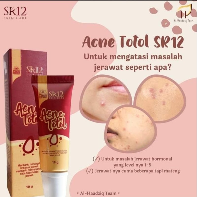 SALEP JERAWAT DAN BEKAS JERAWAT /acne totol/ jerawat