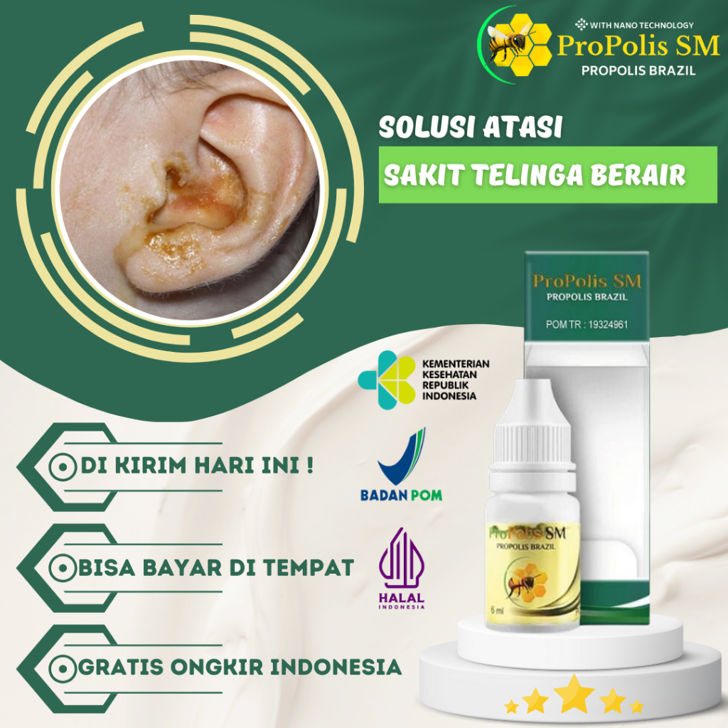 Obat Tetes Telinga Berair Bernanah Bau Busuk Telinga congekObat Sakit Telinga Berdengung, Infeksi Te