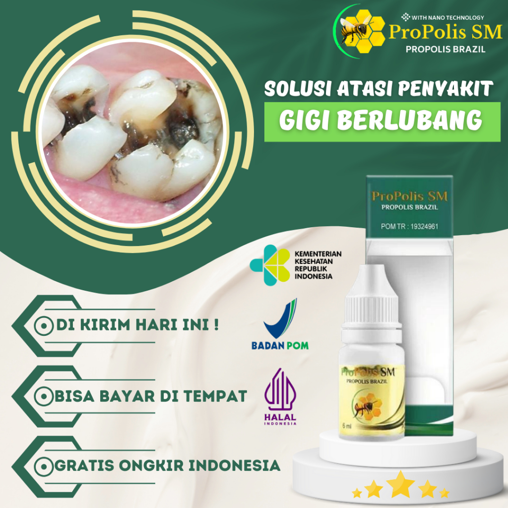Obat Sakit Gigi Berlubang, Penghilang Ulat Gigi, Obat Gusi Bengkak, Sakit Gigi Nyut Nyutan Untuk Ana