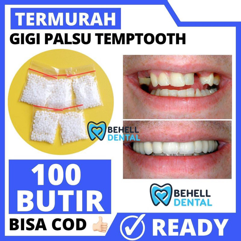 GIGI PALSU SEMENTARA 100 BUTIR / PENAMBAL GIGI PATAH RENGGANG TEMPORARY TOOTH TEMPTOOTH GINGSUL PATA