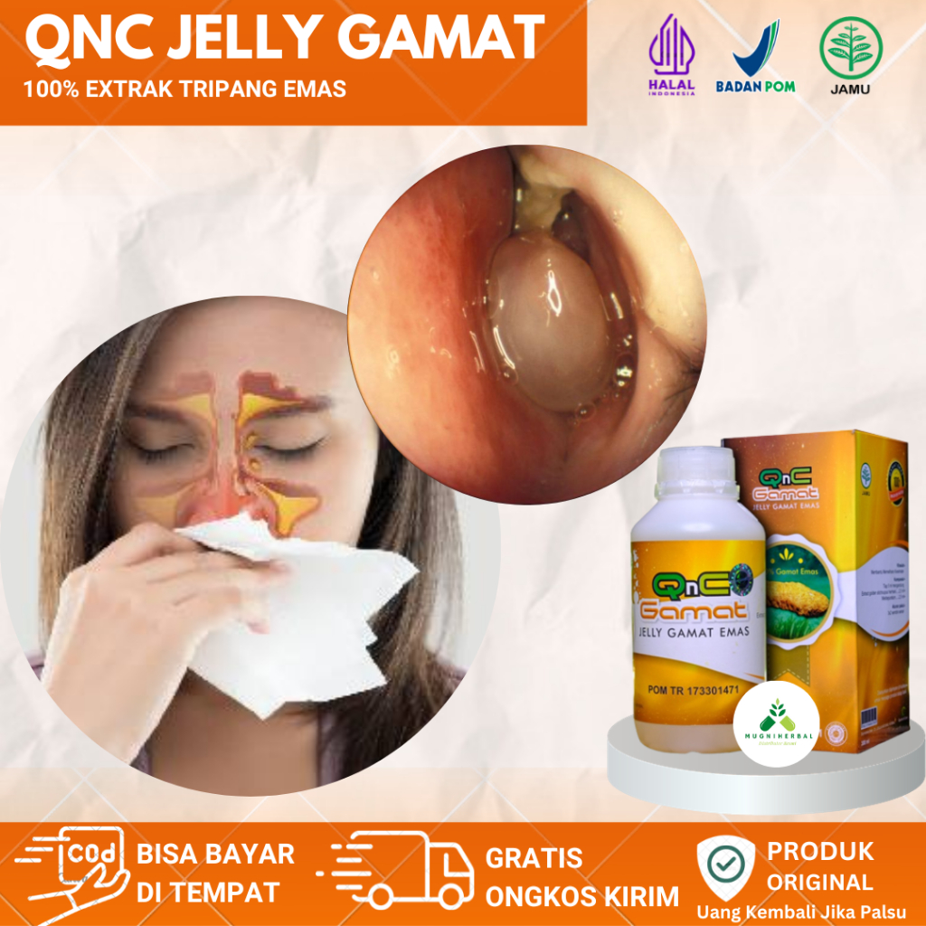 Qnc Jelly Gamat Obat Sinusitis, Infeksi Radang Sinusitis, Polip Hidung, Pilek Menahun, Rhinitis Aler