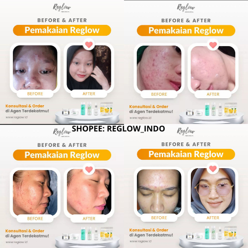 Reglow Intensive Whitening Night Cream Atasi Flek Membandel Mencerahkan & Memperbaiki Tekstur Kulit