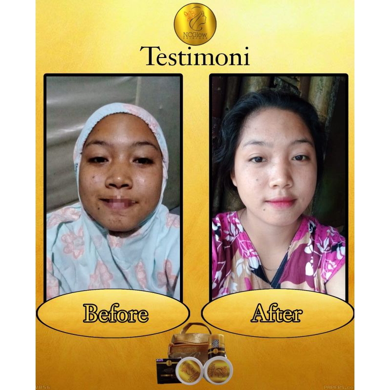 skincare NC GLOW BPOM100%