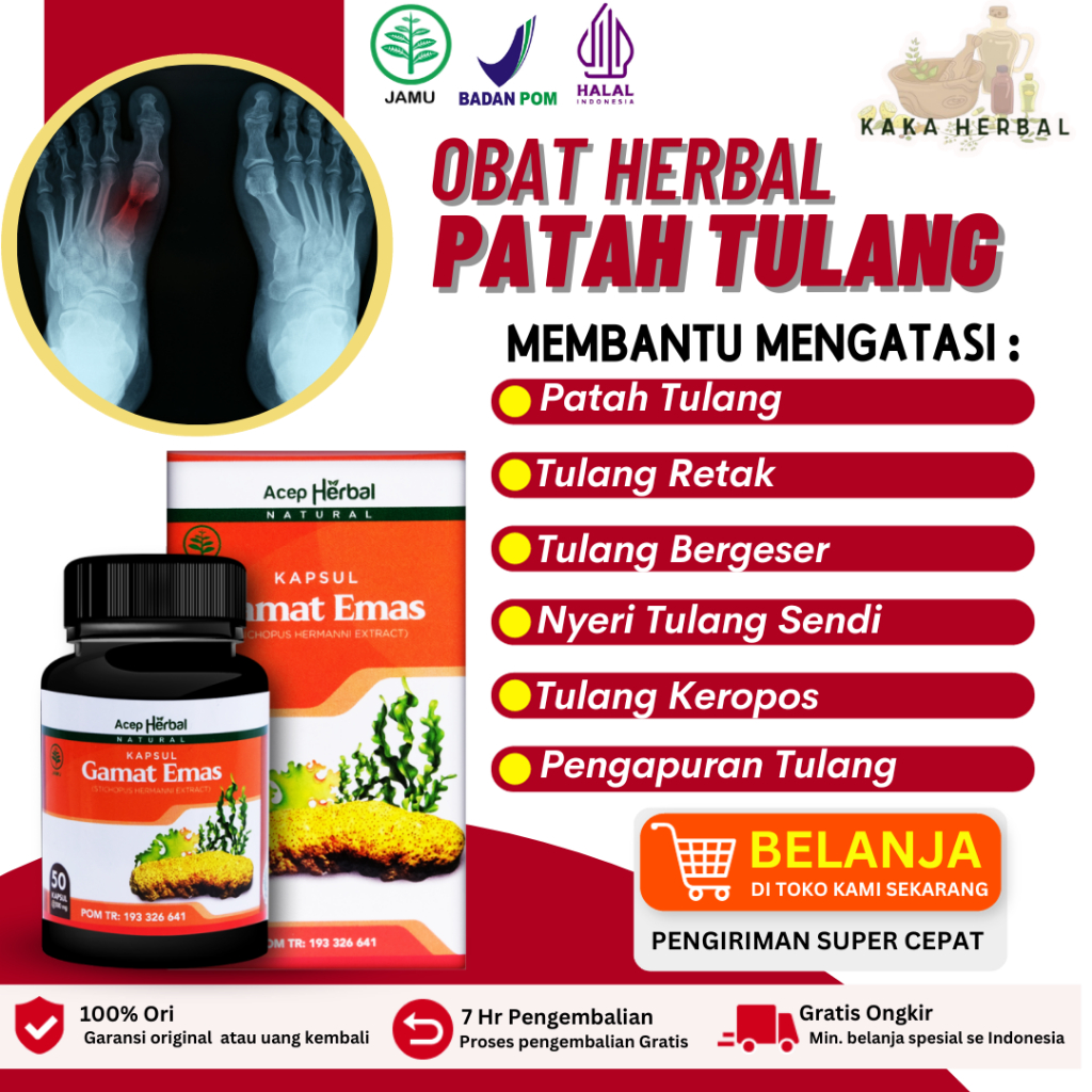 Kaka Herbal - Obat Patah Tulang Dan Retak, Penyambung Tulang, Nutrisi Tulang Herbal, Obat Patah Tula