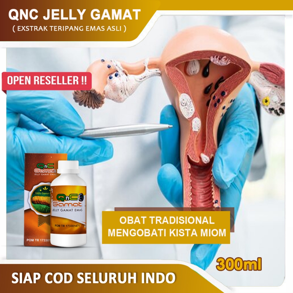 Obat Kista - Obat Miom di Rahim - Kista Batholin - Kista Cokelat - Miom Kista Endometriosis - Polip 