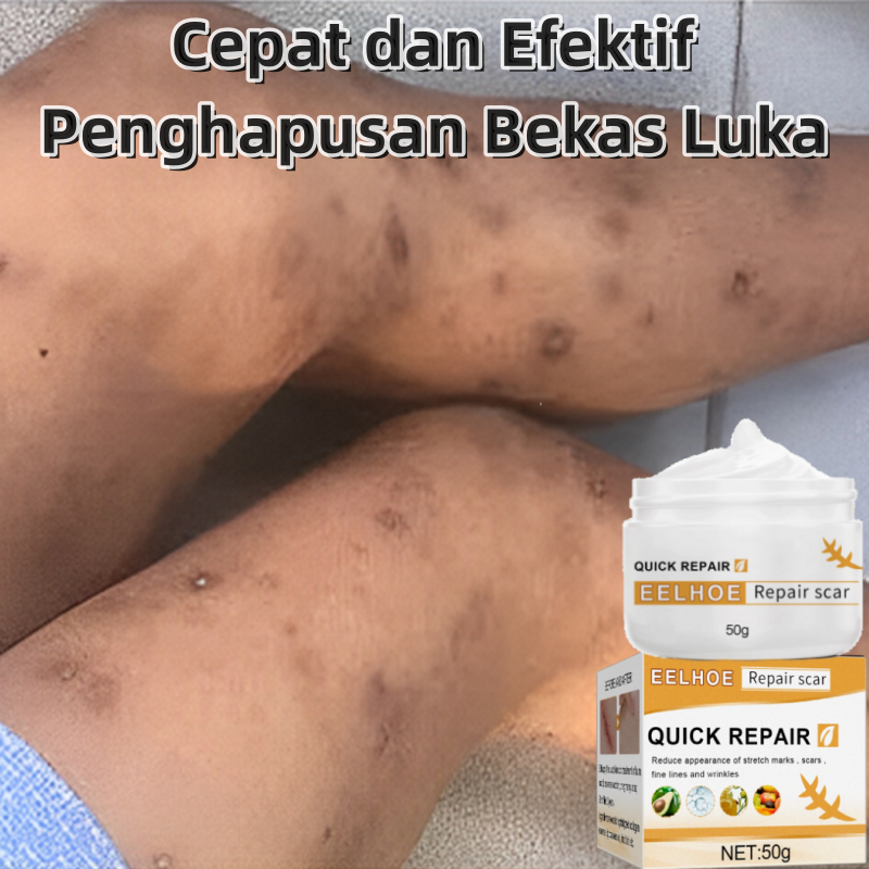 obat penghilang bekas luka bio herbal penghilang bekas luka bio herbal penghilang bekas luka penghil