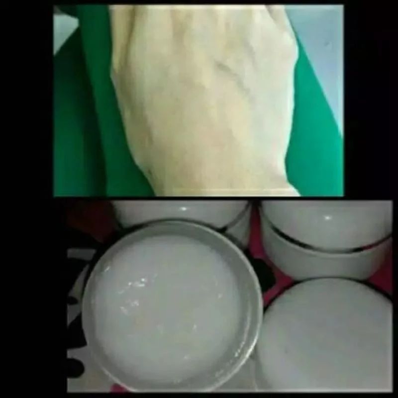 Bibit pemutih grade A original lebih cepat memutihkan kulit