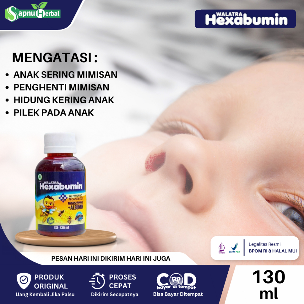 Obat Anak Mimisan, Anak Sering Mimisan, Mimisan Anak, Mimisan Terus Menerus, Pendarahan Dari Hidung,