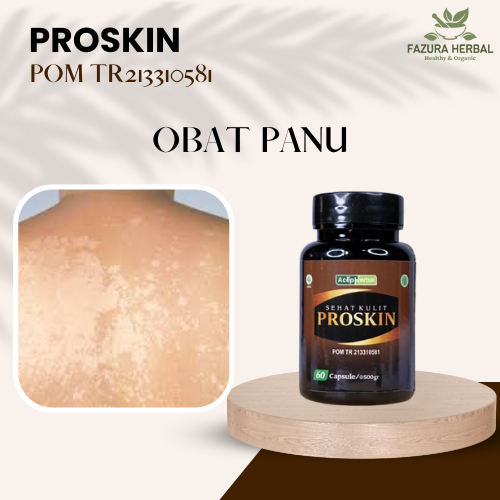 Obat Panu, Obat Gatal Panu, Obat Panu Di Wajah, Obat Panu di Punggung, Obat Panu Di Badan, Obat Berc