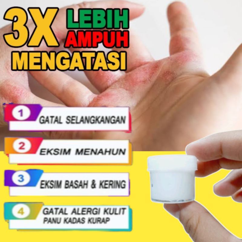 salep gatal² pada kulit racikan paling ampuh
