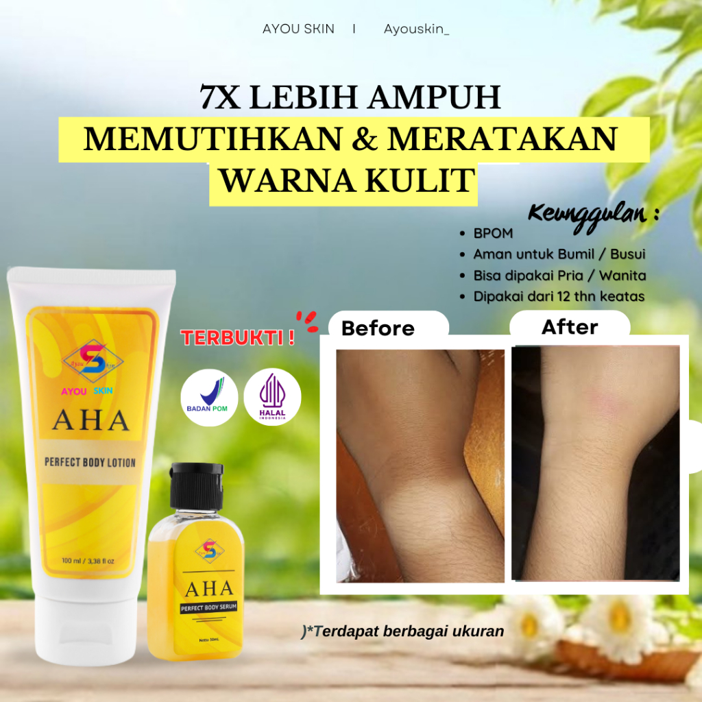 Menghilangkan Belang Di Tangan, Peghilang Tangan Belang, Handbody Tangan Belang, Pemutih Tangan Yang