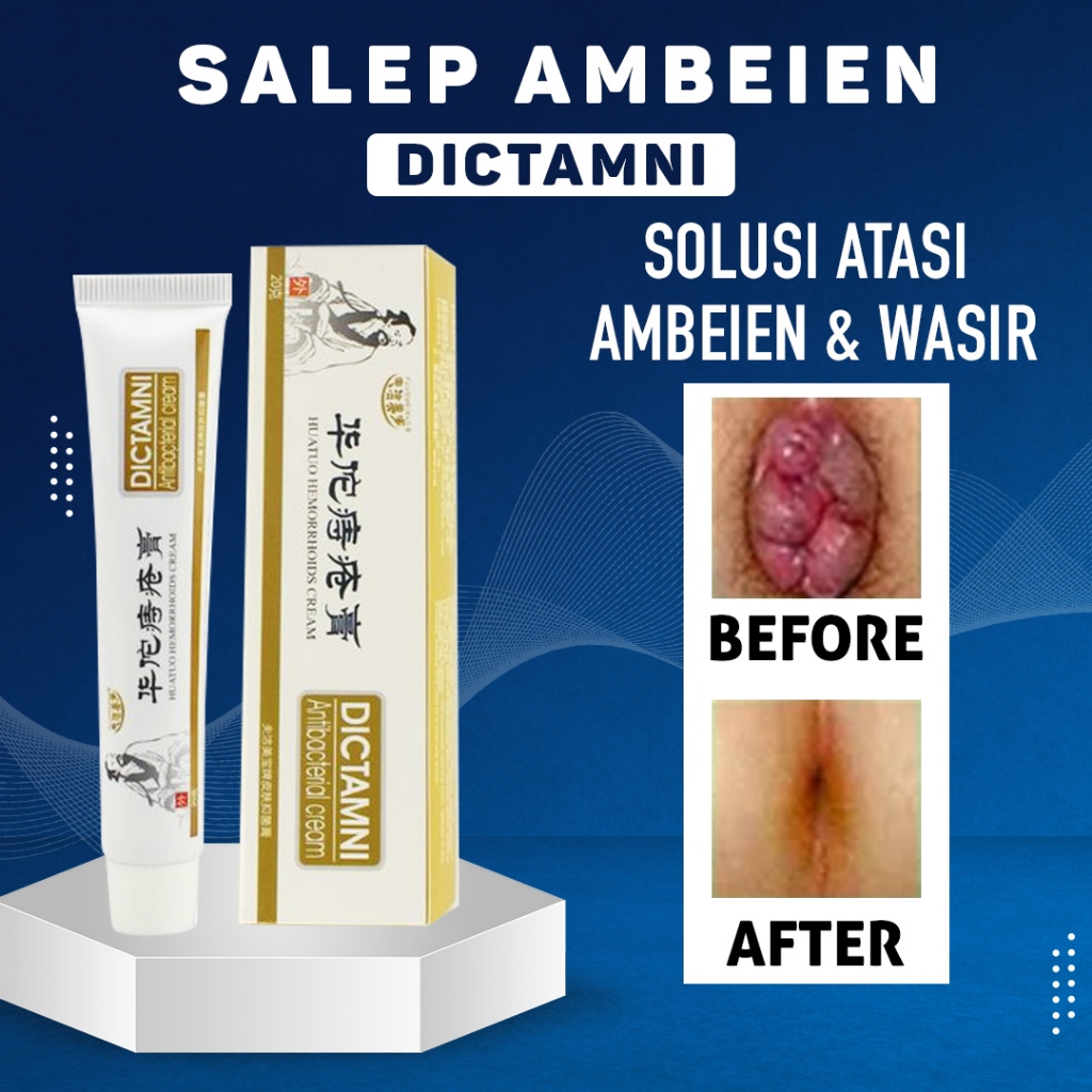 Dictamni Salep Wasir Obat China Ampuh Mengobati Ambeyen Ambeien