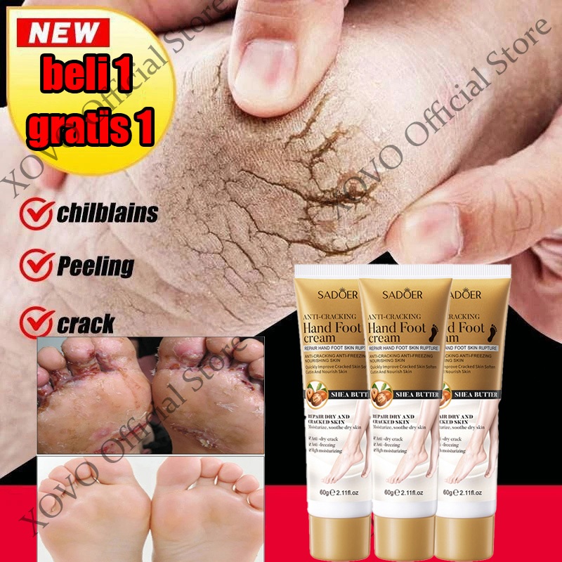 4dpkj- kaki obat kaki pecah dan kering krim obat kaki pecah pecah 60g alat kaki pecah pecah cream