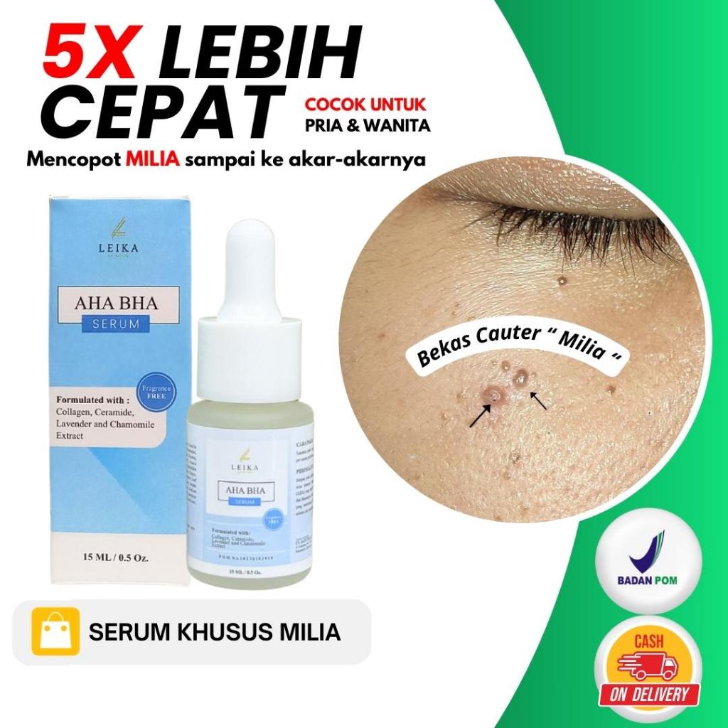 PENGHILANG BEKAS CAUTER MILIA !! Serum aha bha penghilang milia dibawah mata kelopak mata hidung pip