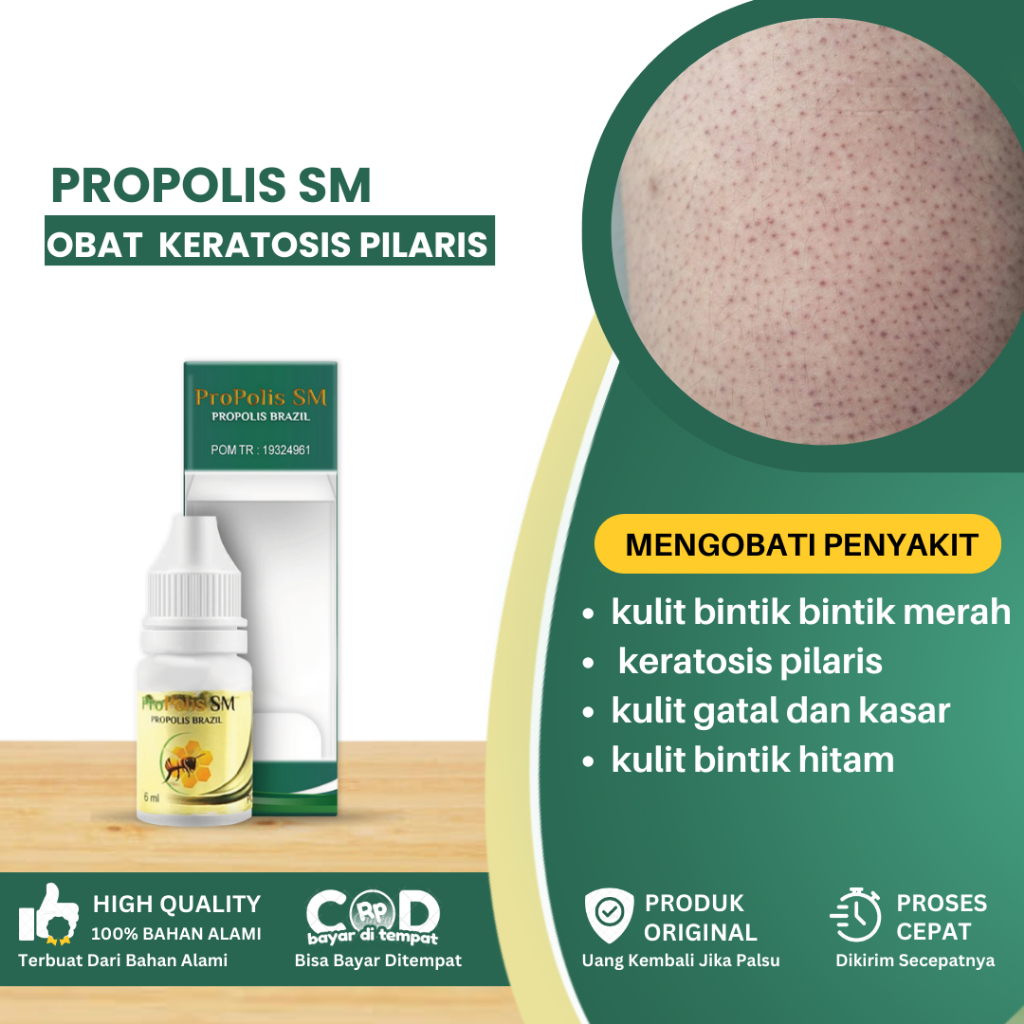 Obat Keratosis Pilaris, Obat Kulit Bintik - Bintik Hitam, Obat Penghilang Bintik Kemerahan Di Wajah 