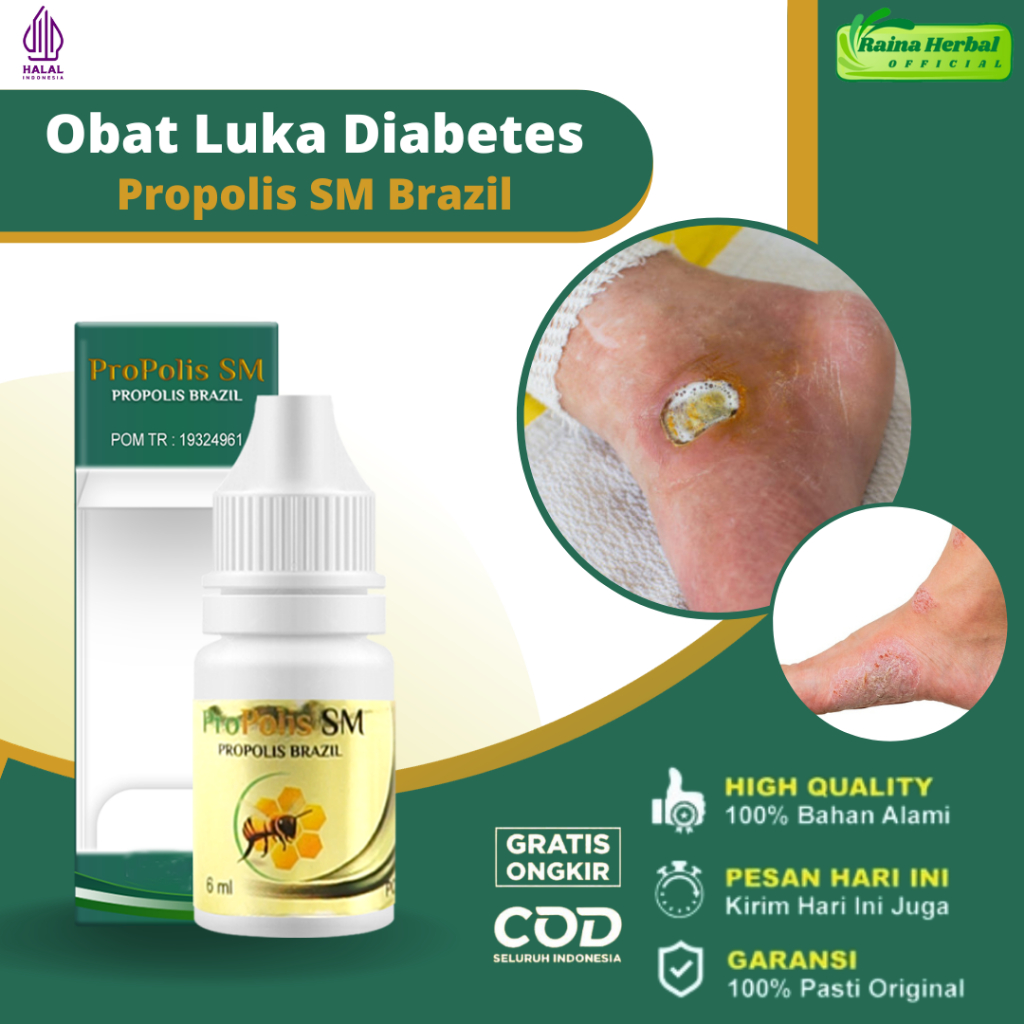 Obat Pengering Luka Diabetes Obat Luka Diabetes Basah Luka Diabetes Kering Luka Diabetes Bernanah Lu