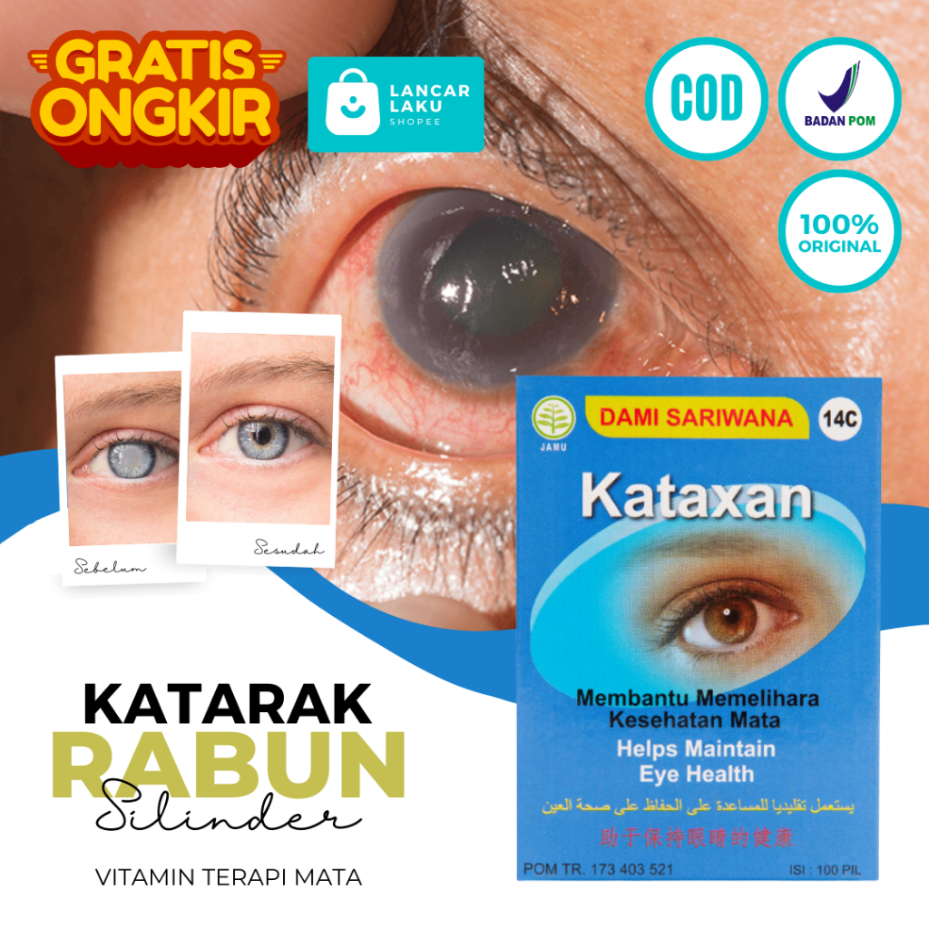 Obat Mata Minus Paling Ampuh Penghilang Katarak Rabun Jauh Obat Tetes Mata Herbal Noni Eye Original