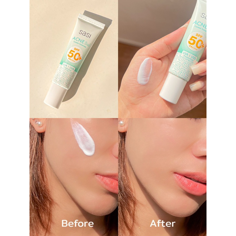 SASI ACNE SOL SUNSCREEN UNTUK ACNE PRONE SKIN