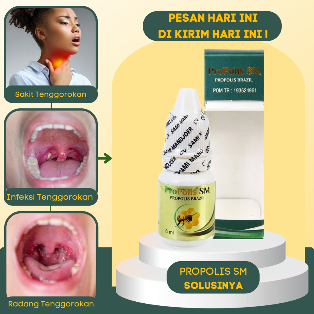 Obat Radang Tenggorokan Anak - Obat Radang Tenggorokan Dewasa - Obat Sakit Tenggorokan Saat Menelan 