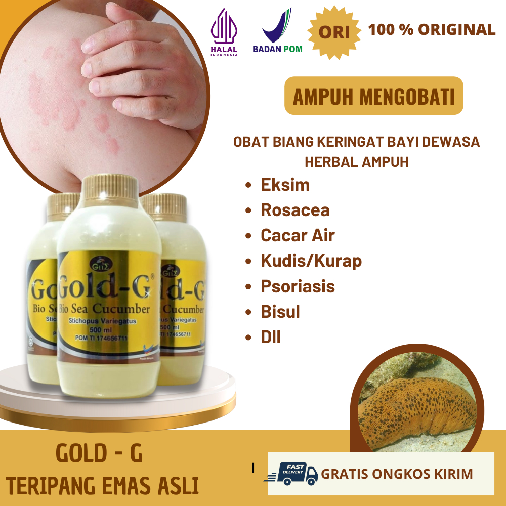 Obat Biduran Alergi Ampuh 100% Original, Bentol atau Ruam Kemerahan, Gatal, Sensasi Seperti Terbakar